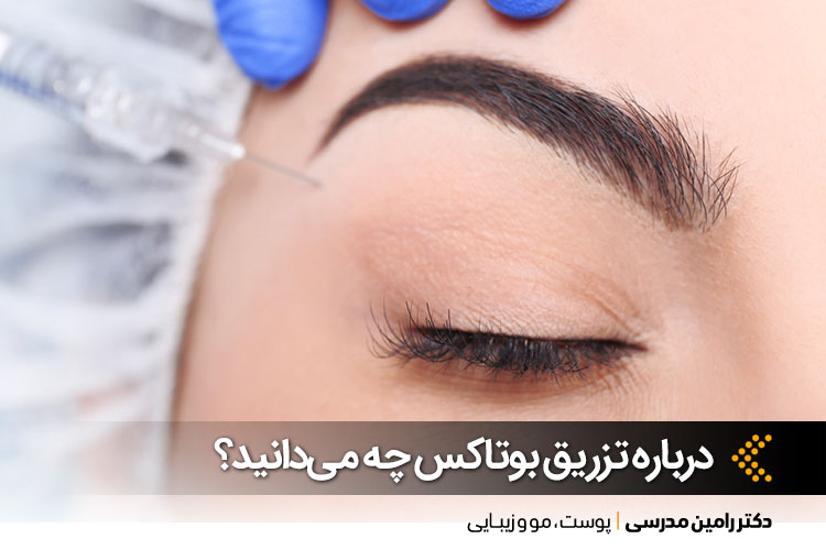 تزریق بوتاکس در اصفهان