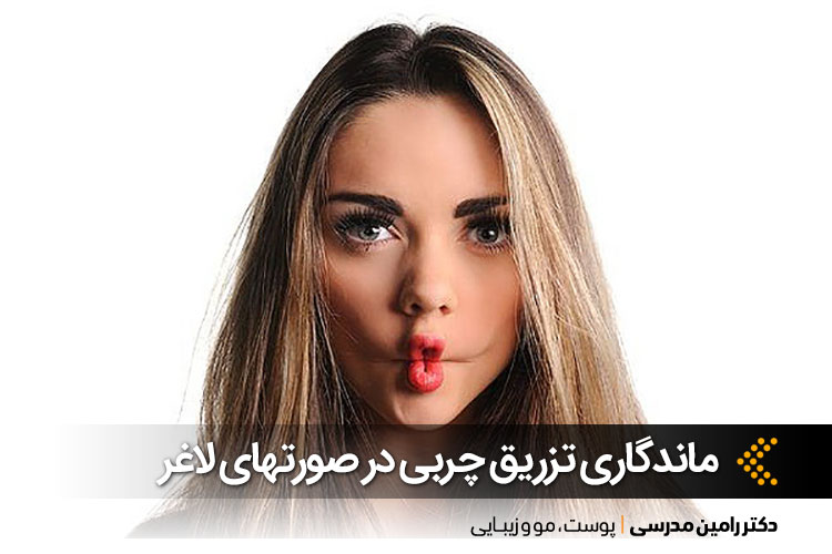 تزریق چربی صورتهای لاغر در اصفهان