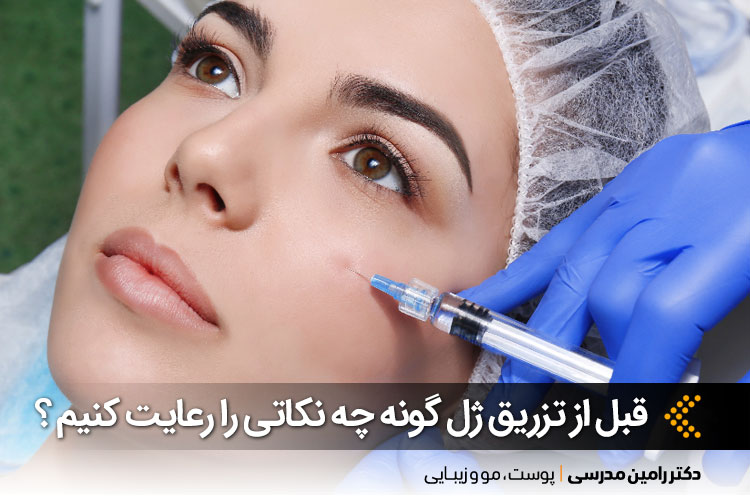 اقدامات قبل از تزریق ژل گونه