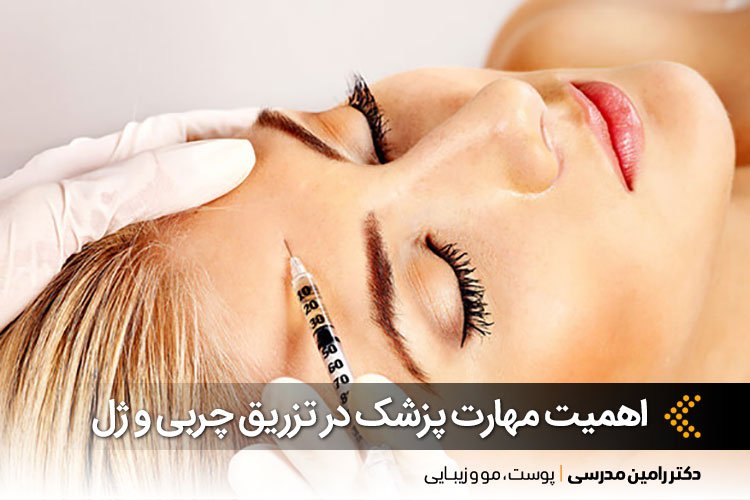 تزریق چربی و ژل در اصفهان