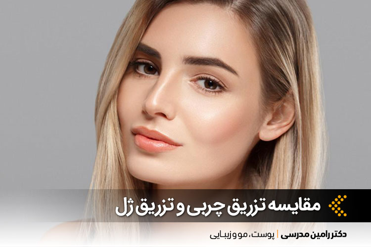 تزریق چربی و تزریق ژل در اصفهان